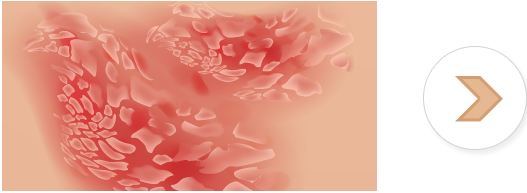 01-14