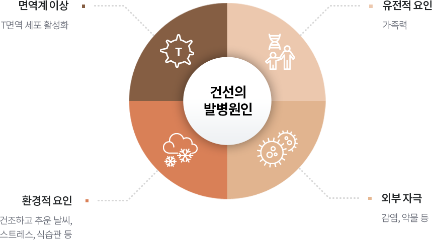 건선의 발병원인, 유전적 요인(가족력), 외부자극(감염, 약물 등), 면역계이상(T세포 활성화), 환경적요인(건조하고 추운날씨, 스트레스, 식습관 등)