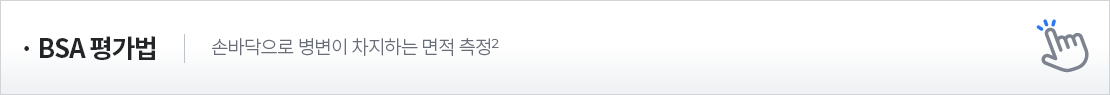 BSA평가법 손바닥으로 병변이 차지하는 면적 측정