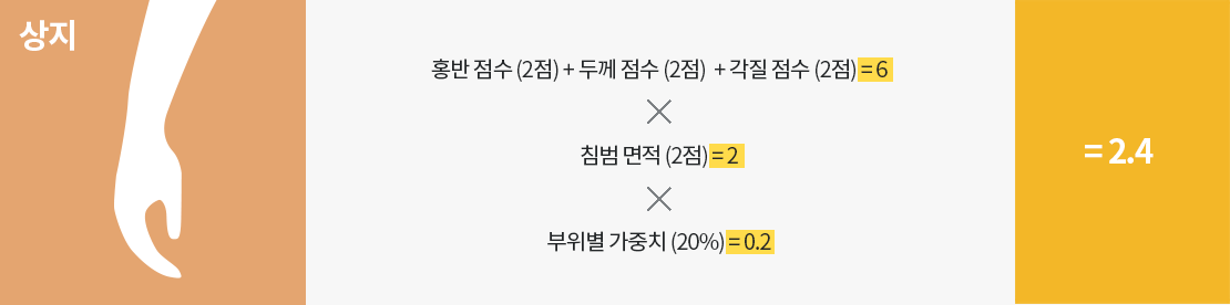 사람의 팔과 손모양 이미지