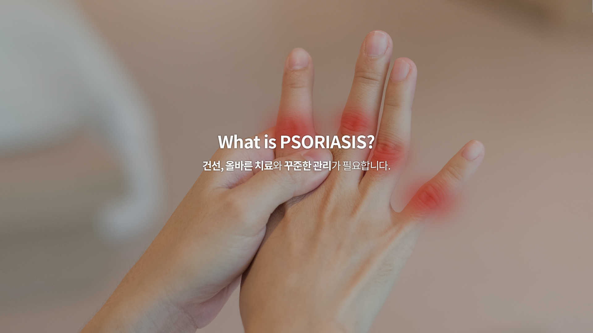 What is PSORIASIS?