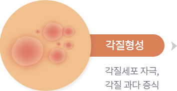 각질형성, 각질세포 자극, 각질 과다 증식